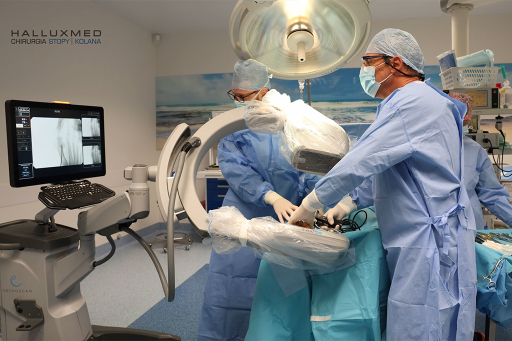 Zespół chirurgów w niebieskich fartuchach i maseczkach wykonuje operację stopy przy użyciu ramienia rentgenowskiego i monitora w nowoczesnej sali operacyjnej.